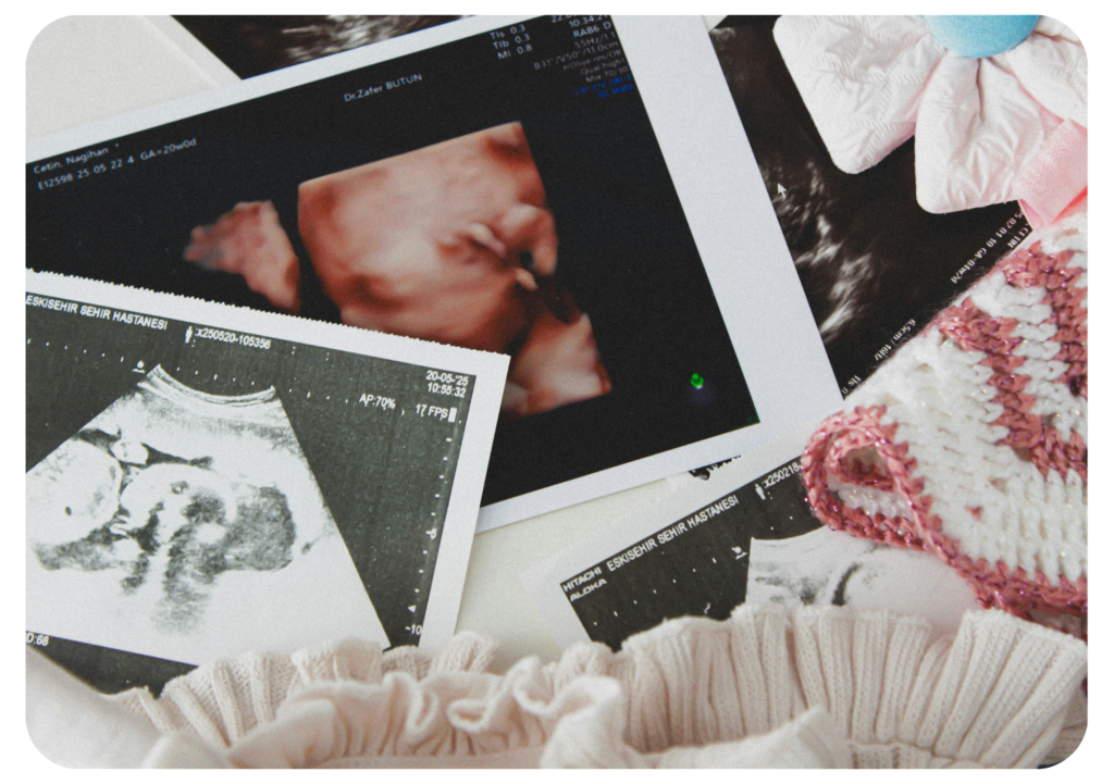 Femme en projet de conception travaillant avec une thérapeute sur la libération des traumatismes avant la grossesse à Vertou proche Nantes
